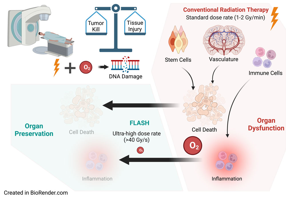 Illustration of the flash radiation process courtesy of Christopher Willey, M.D., Ph.D.