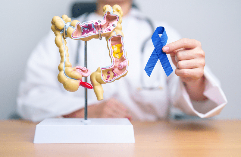 UAB's National Accreditation for rectal cancer